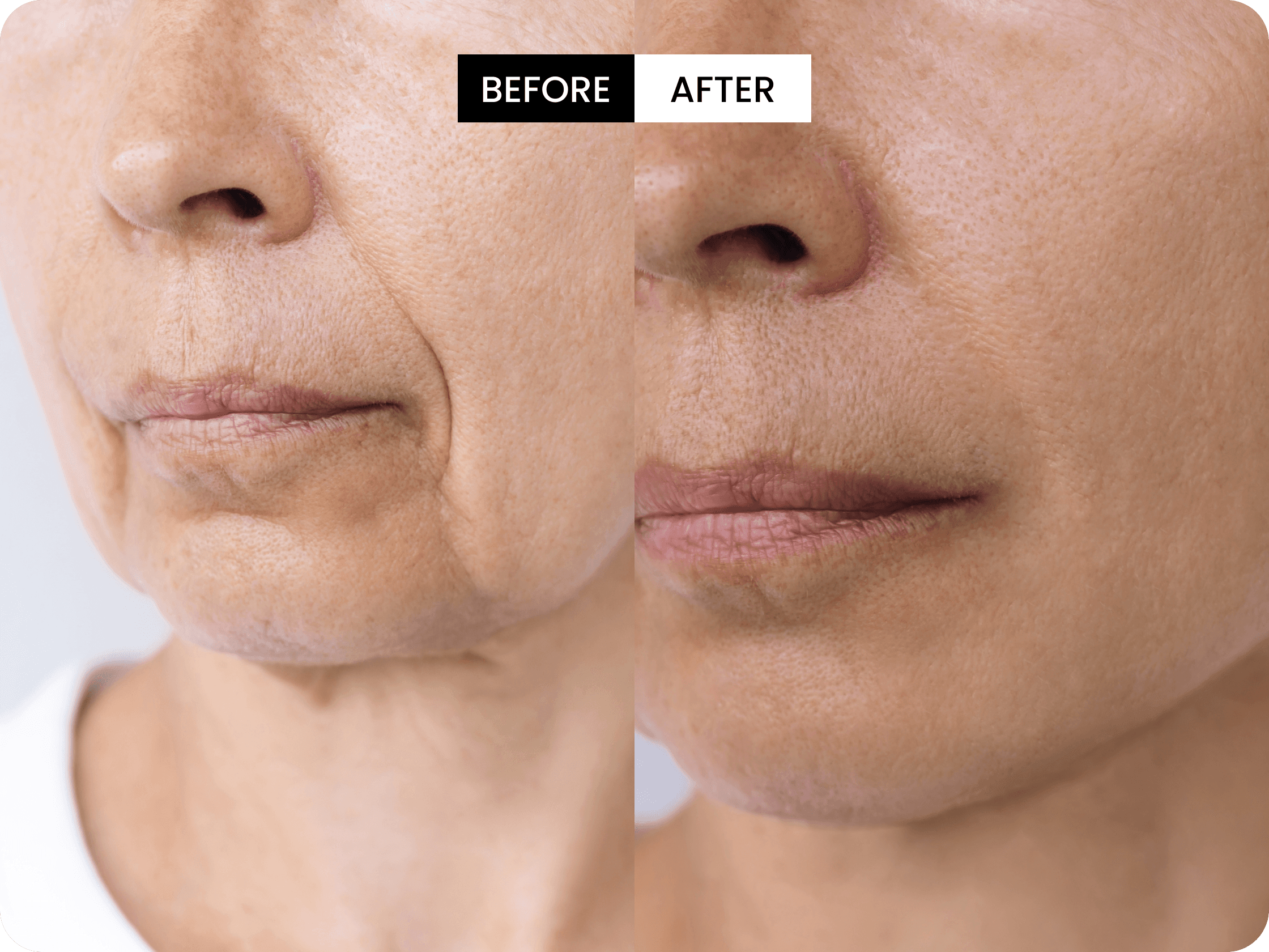 Patricia testimonial