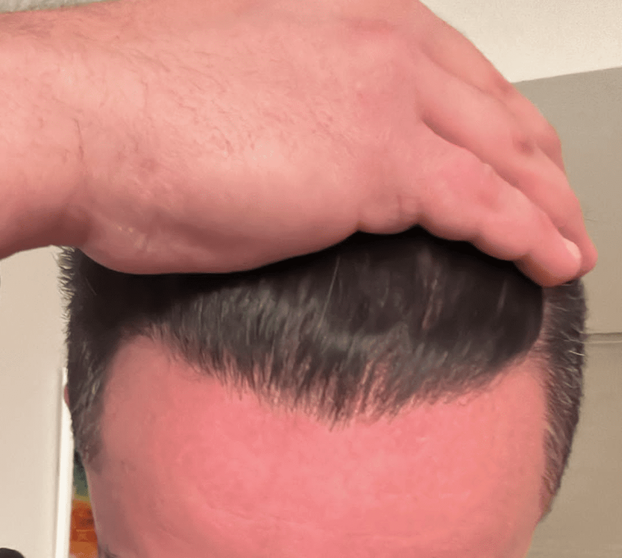 after