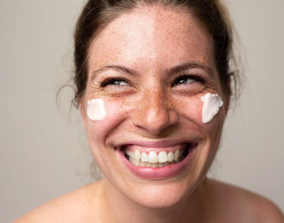Hyperpigmentation